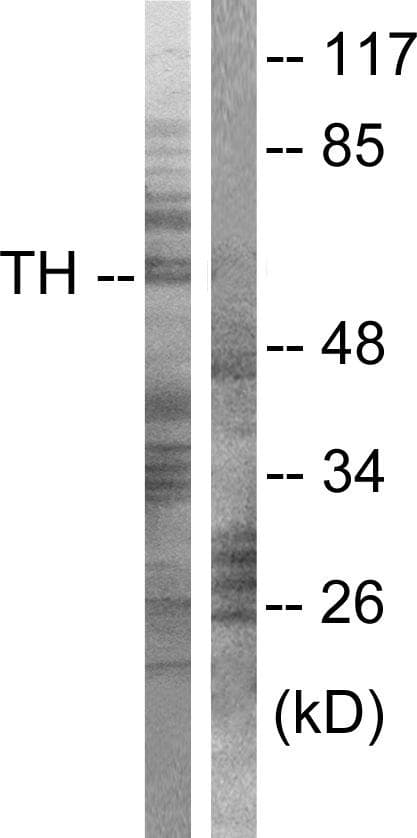 Polyclonal Rabbit anti-Human TH / Tyrosine Hydroxylase Antibody (p40, IHC, IF, WB)