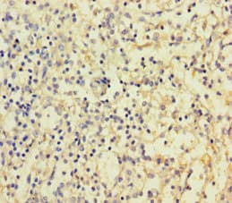 Polyclonal Rabbit anti-Human CD300LF / CD300f Antibody (aa20-156)