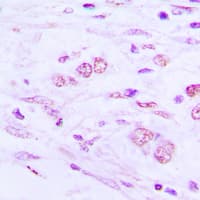 BAIAP2L1 Antibody (Internal)