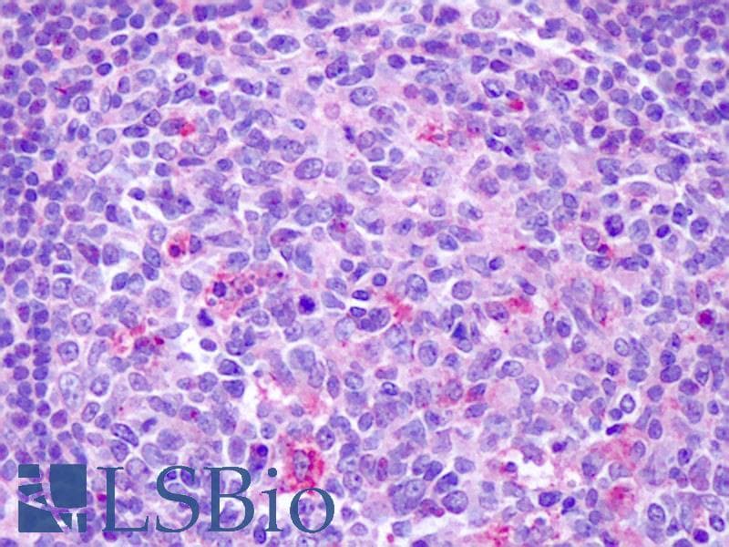 IHC-plus™ CCR7 Antibody (C-Terminus)