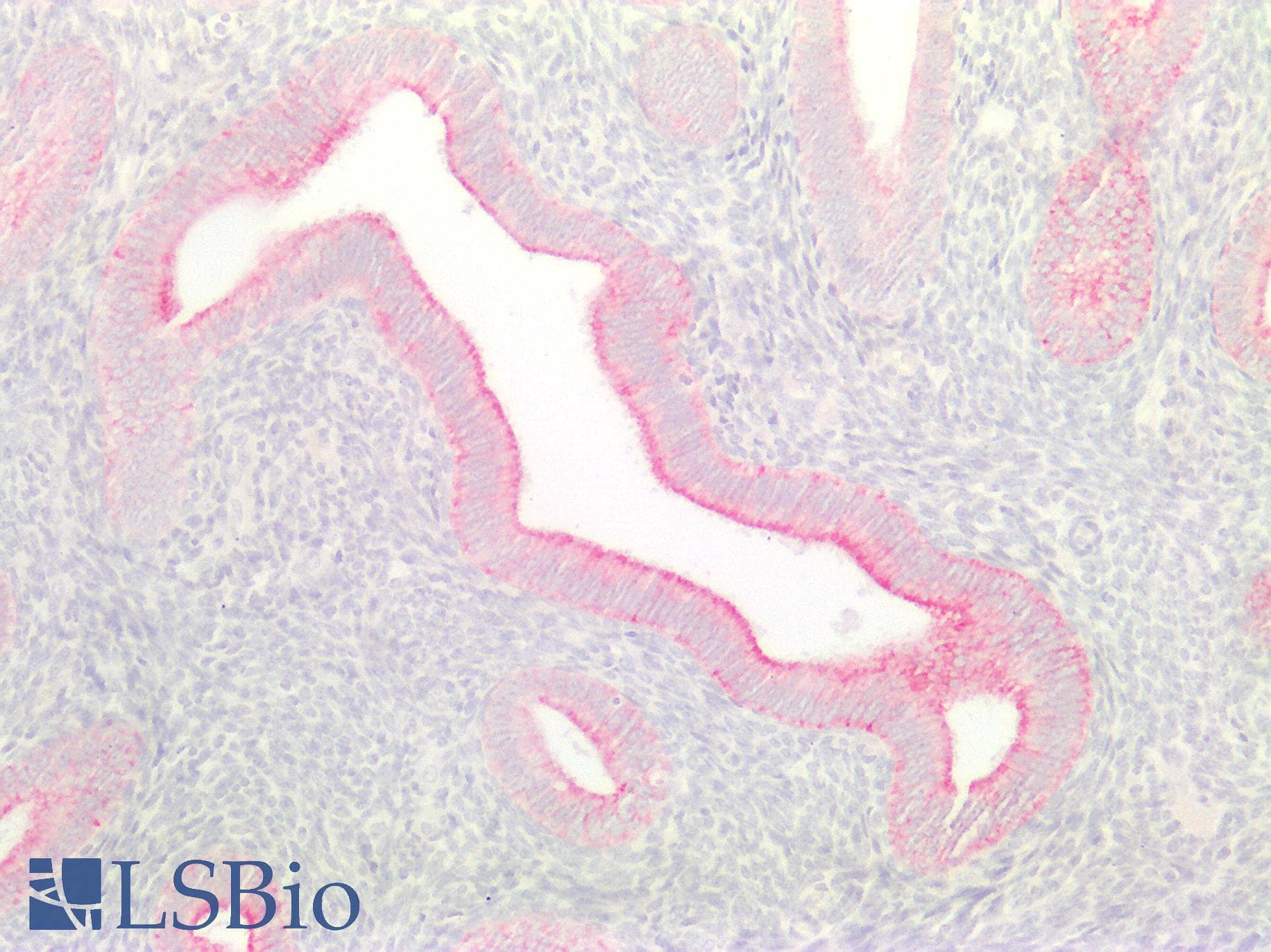 PathPlus™ Monoclonal Mouse anti-Human Cytokeratin AE1+AE3 Antibody (clone AE1 & AE3, IHC)