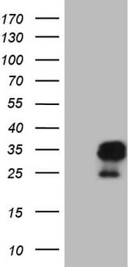 AMTN Antibody (clone OTI1D6)