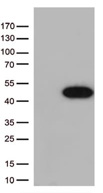 Monoclonal Mouse anti-Human ARG1 / Arginase 1 Antibody (clone OTI1H4, Carrier-free, WB)