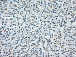 PLK1 / PLK-1 Antibody (clone OTI6C6)