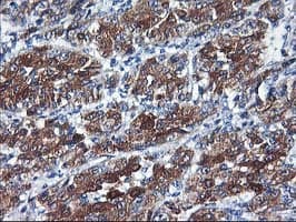 Monoclonal Mouse anti-Human CYP2C9 / Cytochrome P450 2C9 Antibody (clone OTI1D7, IHC, IF, WB)
