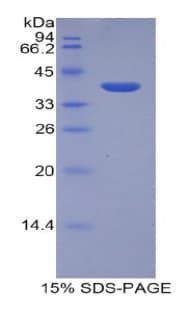 Human LEAP2 Protein (Recombinant His-GST)