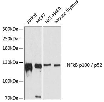 NFKB2 Antibody