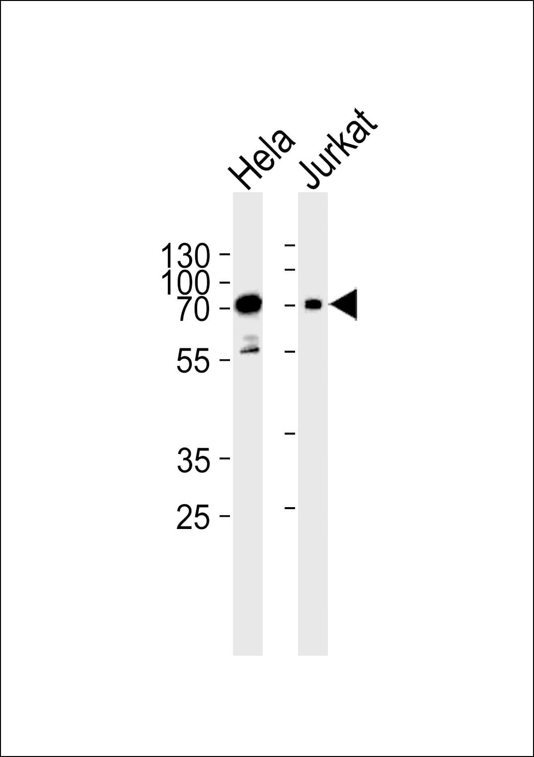 PAK3 Antibody (aa124-152)