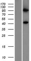 PIGV Protein (Over-Expression Lysate Myc-DDK (Flag))