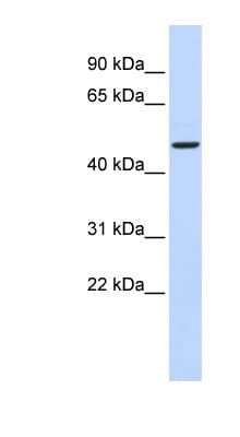 Polyclonal Rabbit anti-Human ADPGK Antibody (aa72-121, WB)