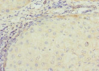 Polyclonal Rabbit anti-Human TSSK3 / STK22C Antibody (IHC)