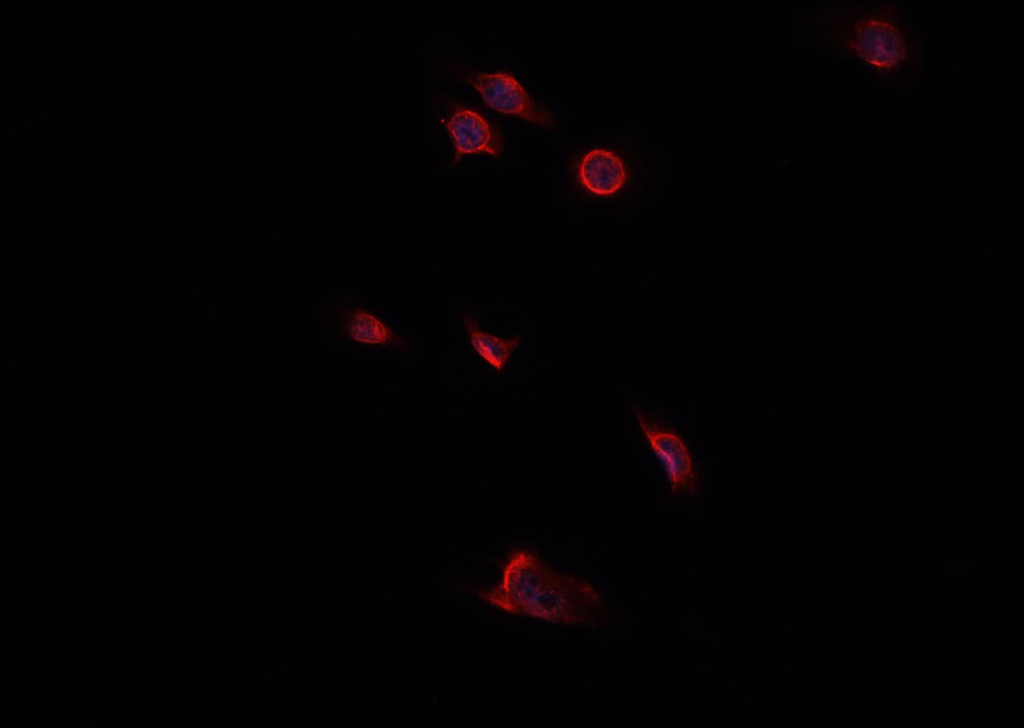 IHC-plus™ DCN / Decorin Antibody
