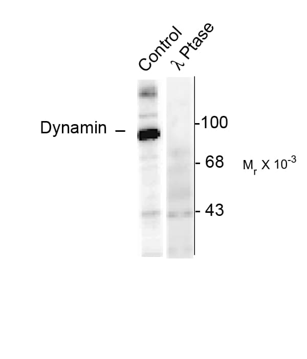 DNM1 / Dynamin Antibody (phospho-Ser774)