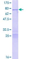 Human PSMC5 / SUG1 Protein (Recombinant GST)