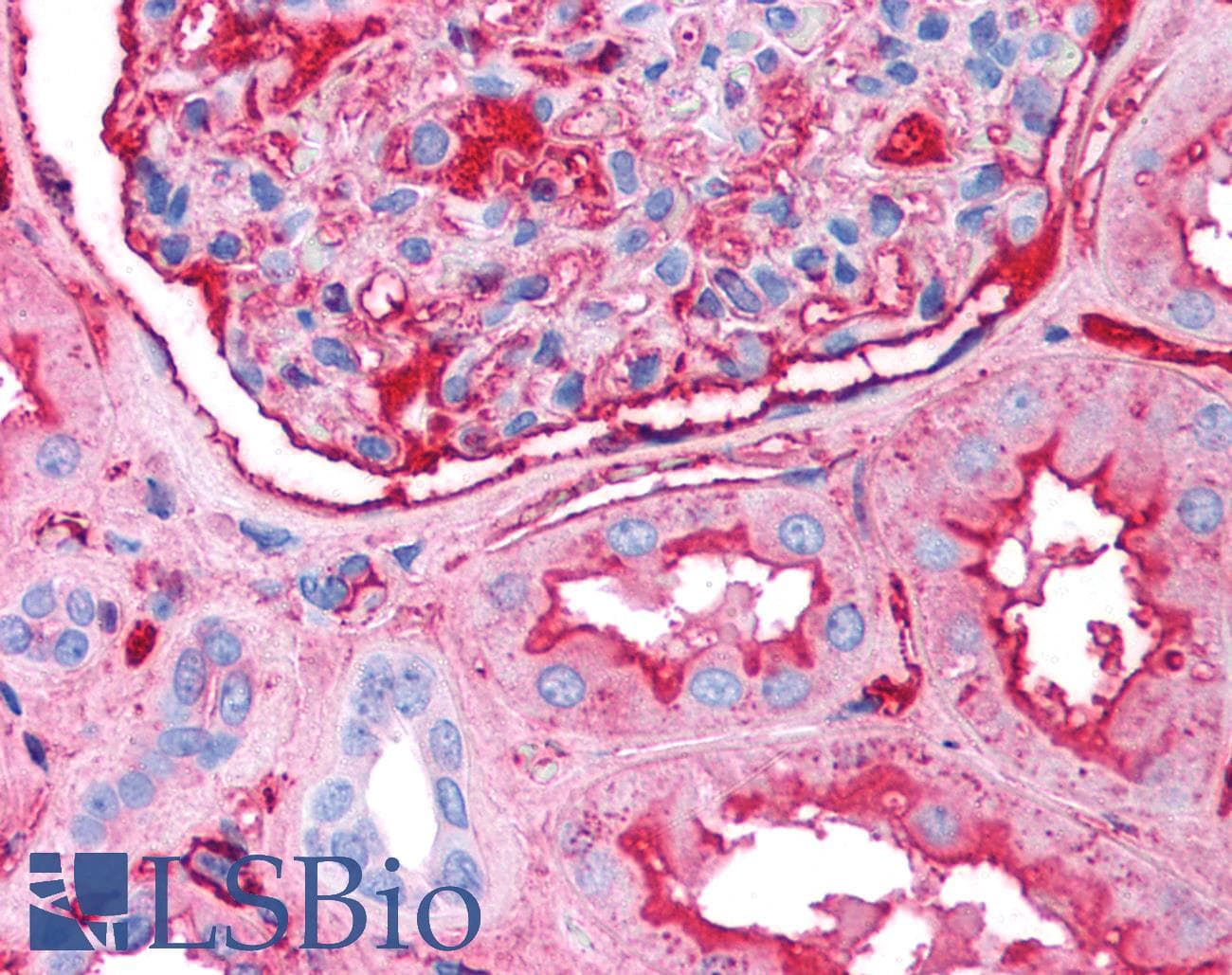 IHC-plus™ Polyclonal Rabbit anti-Human FN1 / Fibronectin Antibody (IHC, WB)