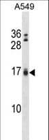 Polyclonal Rabbit anti-Human BIK Antibody (aa39-74, IHC, WB)