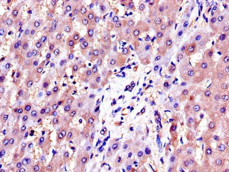 AKR1B1 / Aldose Reductase Antibody