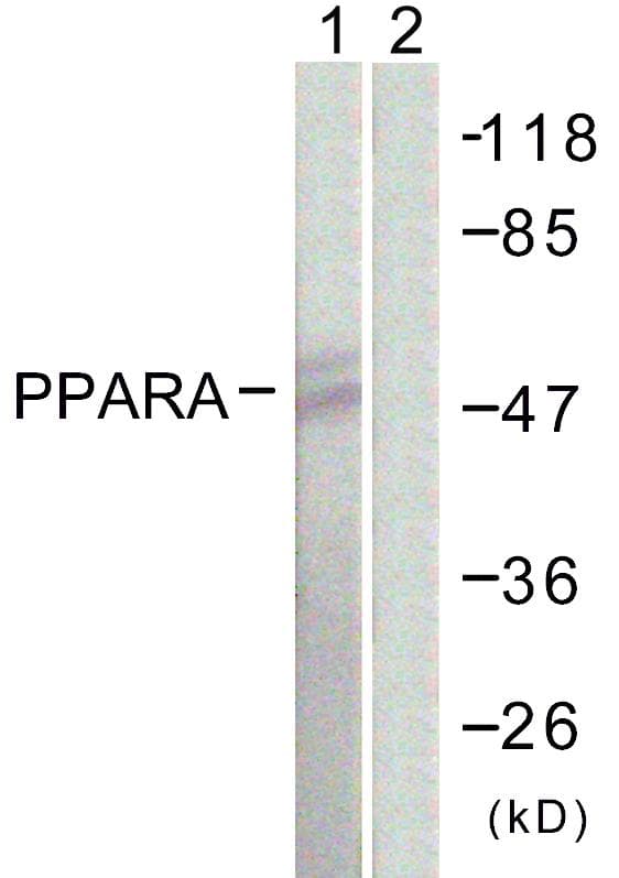 PPARA / PPAR Alpha Antibody (p21)