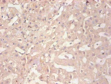 FTL / Ferritin Light Chain Antibody