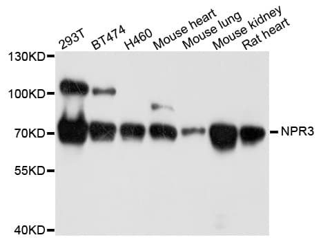 IHC-plus™ NPR3 Antibody