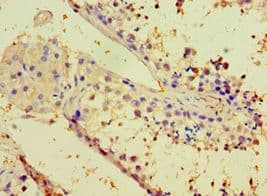 CALR3 Antibody (aa135-384)