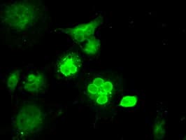 LEMD3 / MAN1 Antibody (clone OTI4E1, Carrier-free)