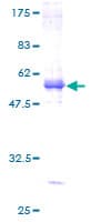 Human SLC30A6 Protein (Recombinant GST)