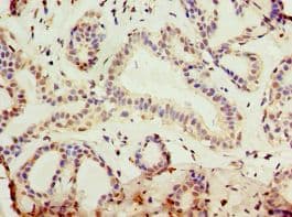 Polyclonal Rabbit anti-Human KLF3 Antibody (aa1-240, IHC)