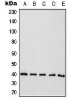 Polyclonal Rabbit anti-Human ATP1B3 Antibody (Internal, WB)