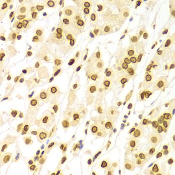 LMNA / Lamin A+C Antibody