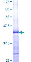 Human PRDM2 / RIZ1 Protein (Recombinant GST, N-terminus)