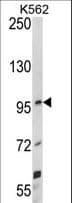 UNC5H3 / UNC5C Antibody (aa188-217)