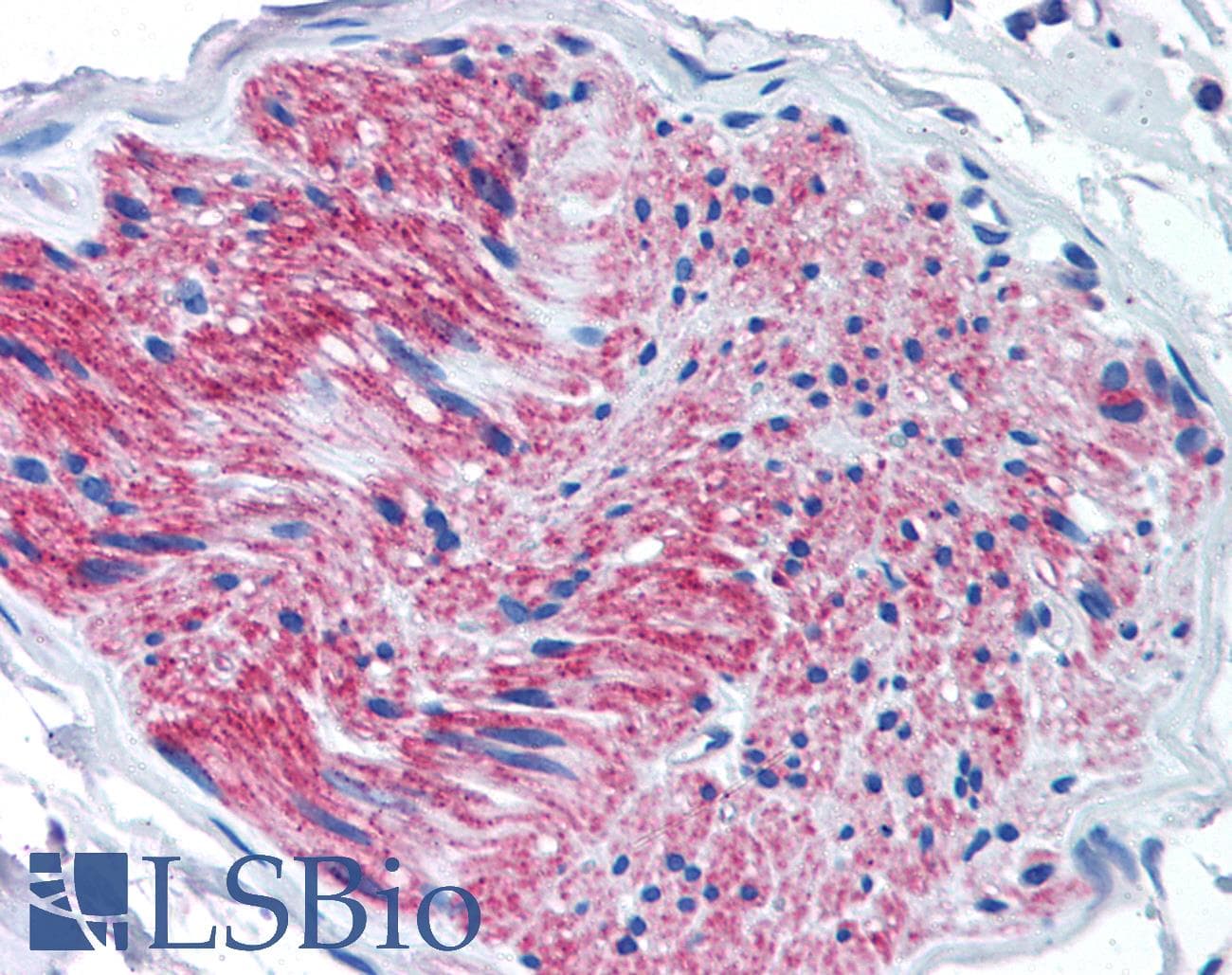 IHC-plus™ P2RX7 / P2X7 Antibody (Internal)