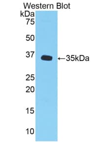 CXCL1 / GRO Alpha Antibody (aa25-96, PE)