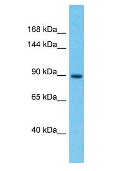 Polyclonal Rabbit anti-Human IGSF22 Antibody (aa120-169, WB)