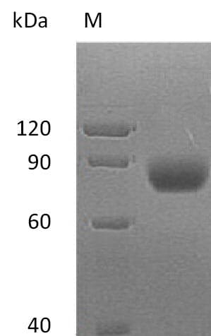 Human MICA Protein (Recombinant Fc, C-terminus)