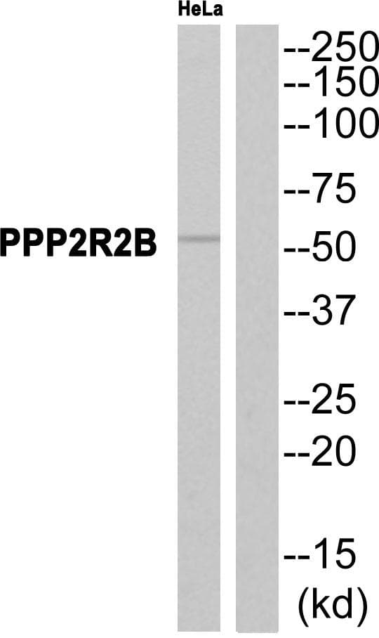 Polyclonal Rabbit anti-Human PPP2R2B Antibody (WB)