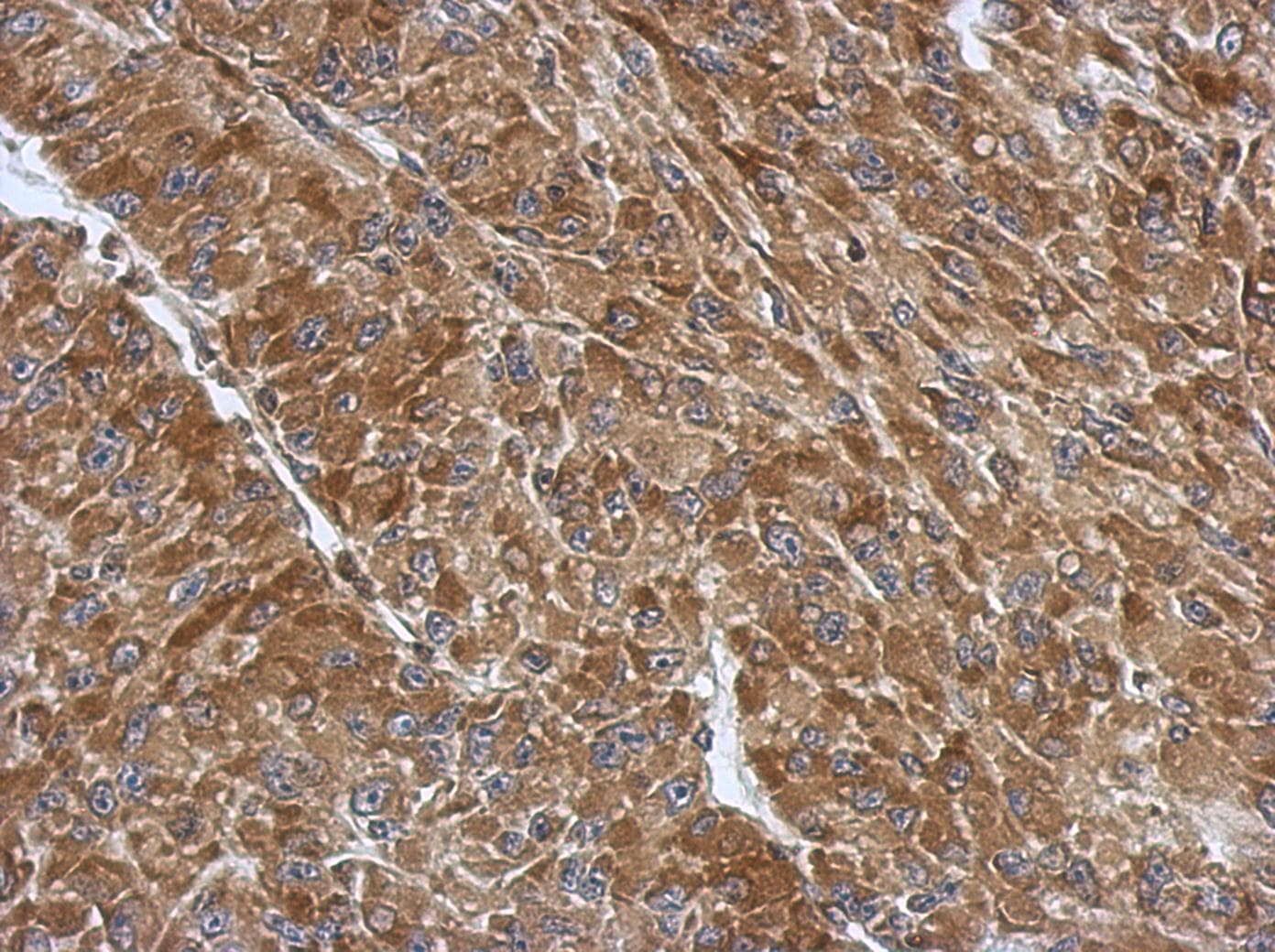 RPS3A / Ribosomal Protein S3A Antibody