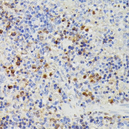 Polyclonal Rabbit anti-Human DUT / DUTPase Antibody (IHC, IF, WB)