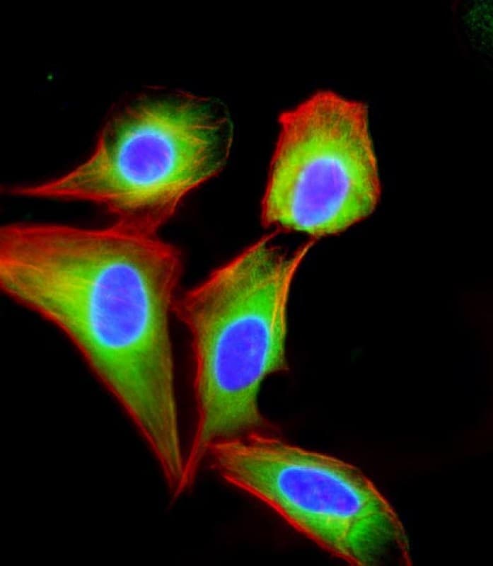 EIF2B3 Antibody (clone 1778CT889.66.6.54)