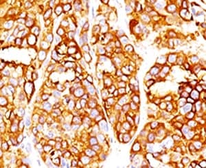 MLANA / Melan-A Antibody (clone RMMRT1-1)