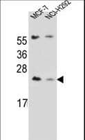 LIN7C / VELI3 Antibody (aa168-197)