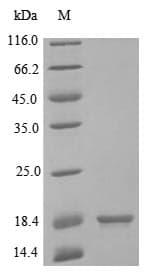 Human IL2 Protein (Recombinant 6His, C-terminus)