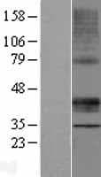 STARD3 / MLN64 Protein (Over-Expression Lysate Myc-DDK (Flag))