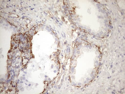 Monoclonal Mouse anti-Human KRT16 / CK16 / Cytokeratin 16 Antibody (clone OTI1G1, IHC, WB)