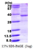 Human HMGCL Protein (Recombinant His)