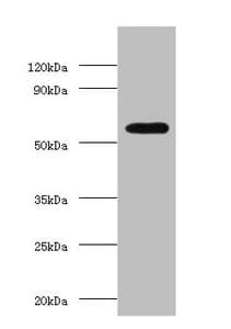 OXCT1 Antibody