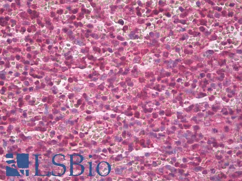 IHC-plus™ Polyclonal Rabbit AHSA1/AHSA2 Antibody (IHC, WB)