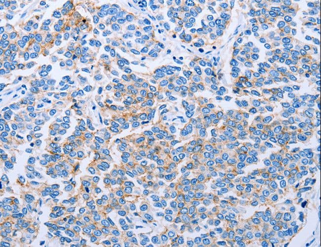 CLDN4 / Claudin 4 Antibody