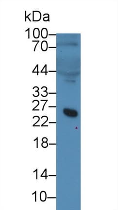 MFAP5 / MAGP2 Antibody (aa24-162)